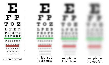 Tabla optométrica con letras para evaluación visual